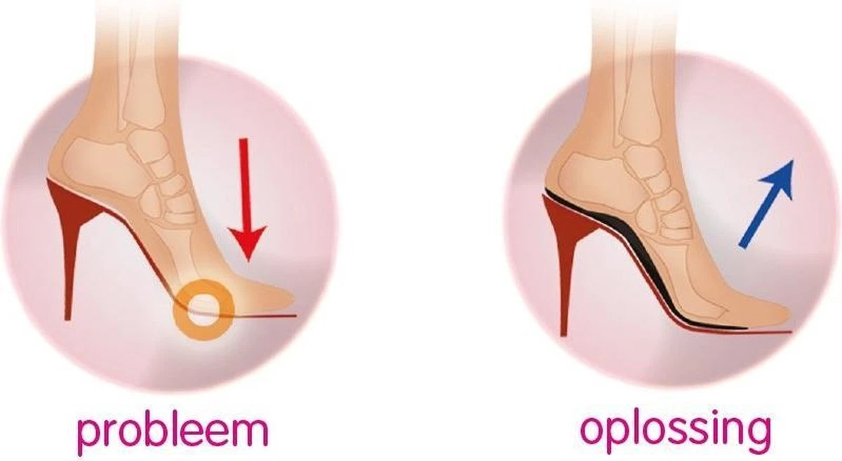 Footlogics Inlegzool HIGHHEELCOMFORT - S (38-40) - Ondersteuning En Comfort In Hoge Hakken - Pumps - Laarzen - Zacht - Veerkrachtig - Onzichtbaar - Schokdempend - Voorkomt Blaren - Bij Rugpijn - Hielpijn - Kniepijn - Vermoeide Voeten 6 Footlogics Inlegzool HIGHHEELCOMFORT - S (38-40) - Ondersteuning En Comfort In Hoge Hakken - Pumps - Laarzen - Zacht - Veerkrachtig - Onzichtbaar - Schokdempend - Voorkomt Blaren - Bij Rugpijn - Hielpijn - Kniepijn - Vermoeide Voeten - Afbeelding 6